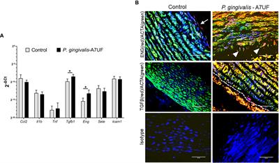 Differential affinity chromatography reveals a link between Porphyromonas gingivalis–induced changes in vascular smooth muscle cell differentiation and the type 9 secretion system